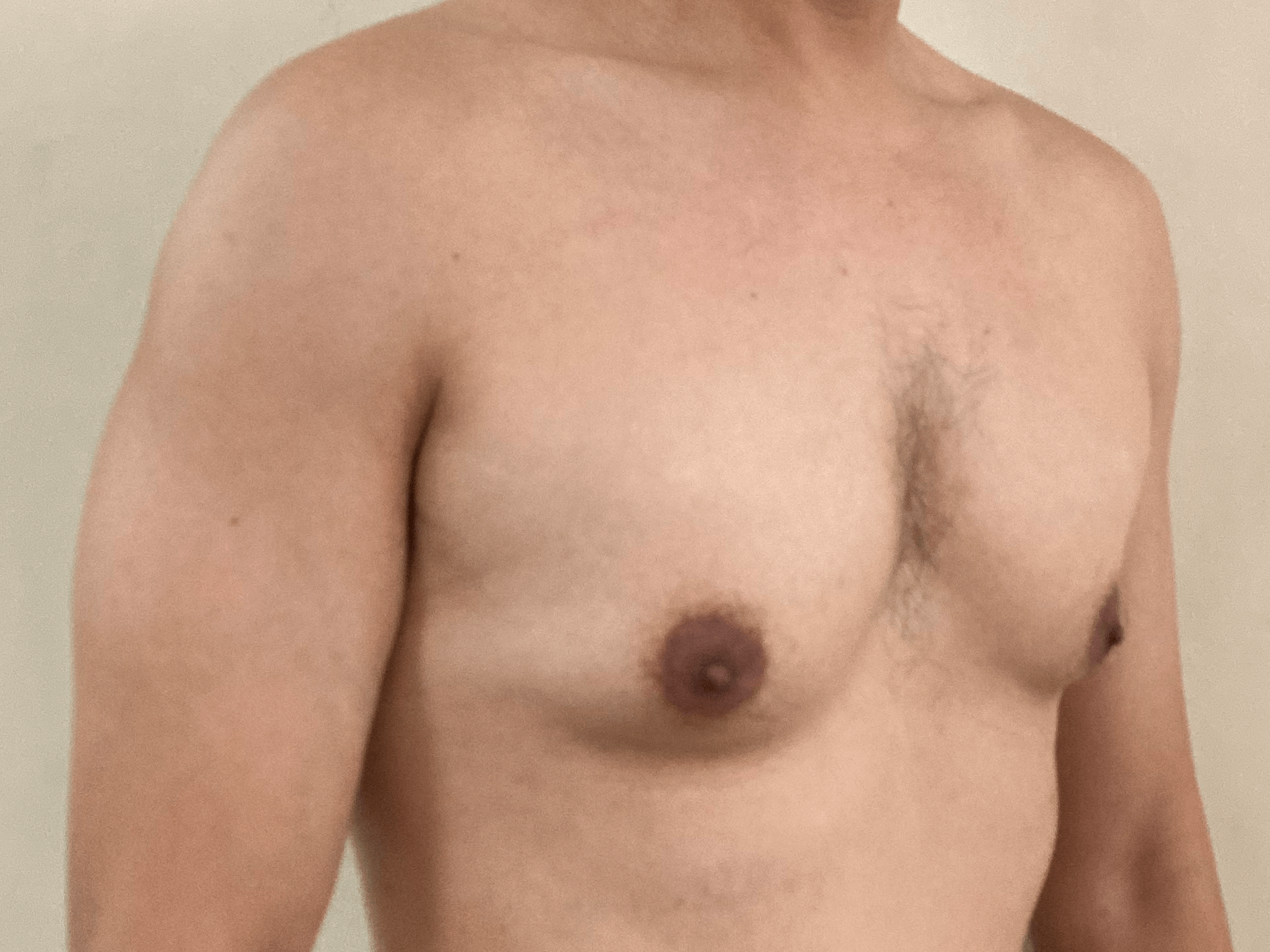 Picture of me shirtless, iso