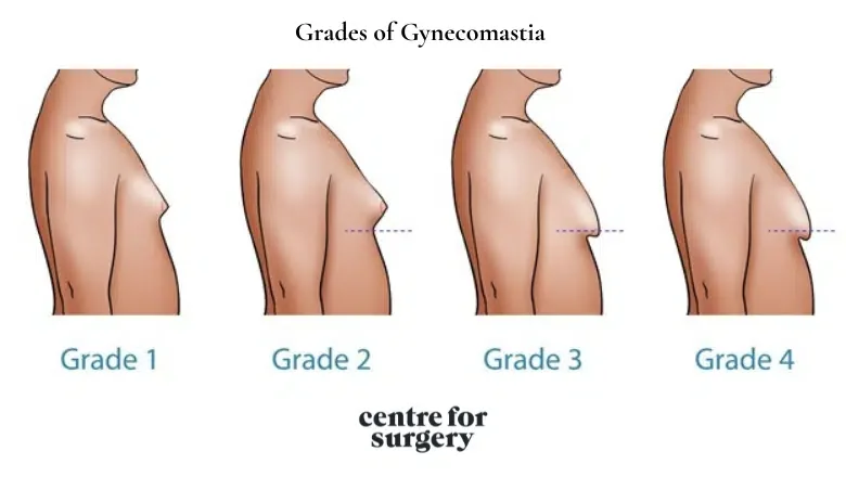 How women find our gyno? Insights from my wife